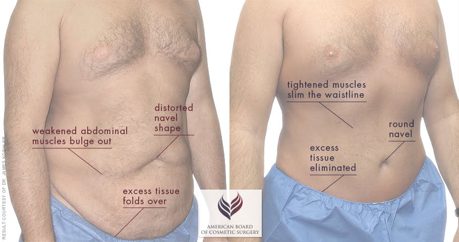 Procedure Overlay