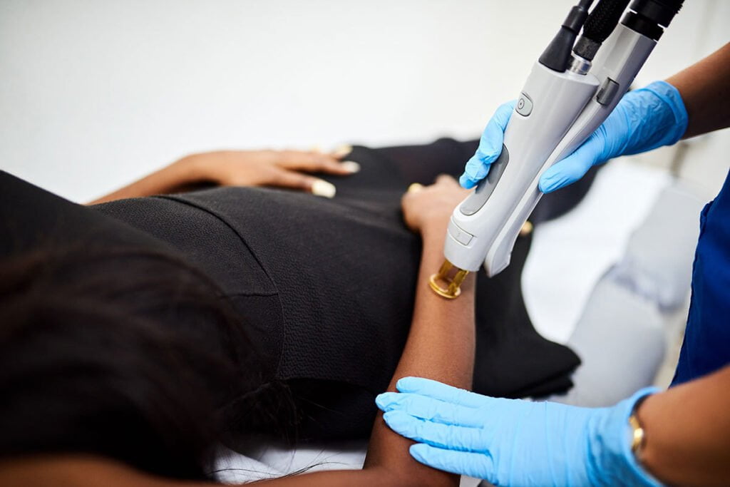 choose a skilled provider who specializes in lasers for medium and dark skin tones