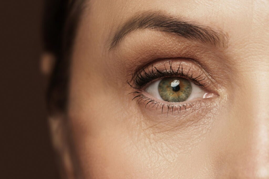 The FDA Approves Juvéderm Volbella XC for Under-Eye Treatment