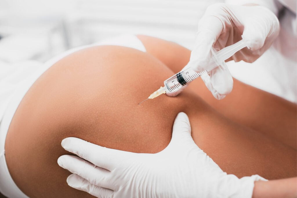 Woman getting injectable cellulite treatment