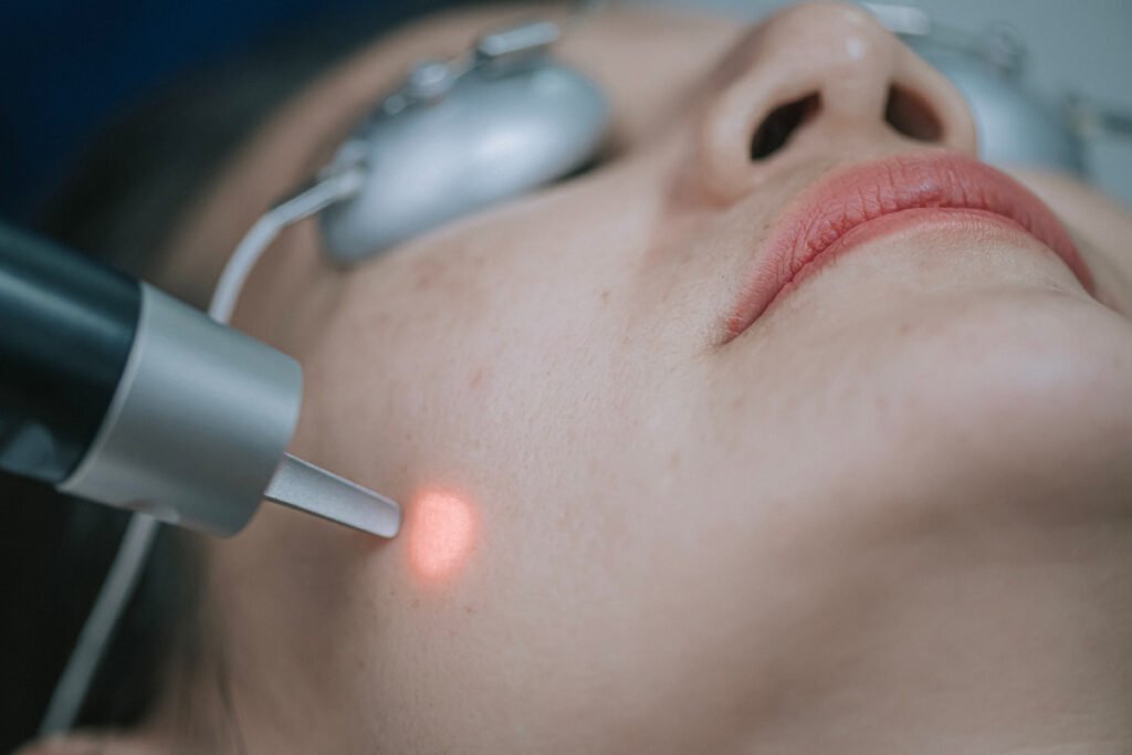 Woman getting IPL laser treatment by a board-certified cosmetic surgeon